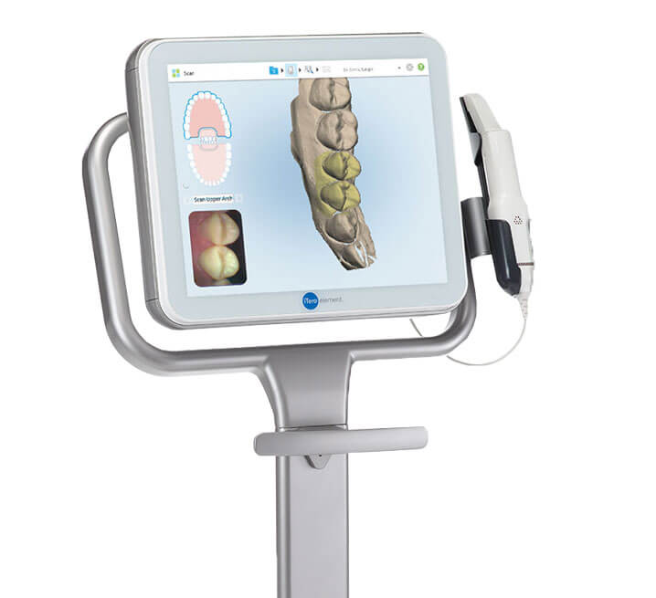 Amplify your Orthodontic Practice with Invisalign & iTero™ Scanner